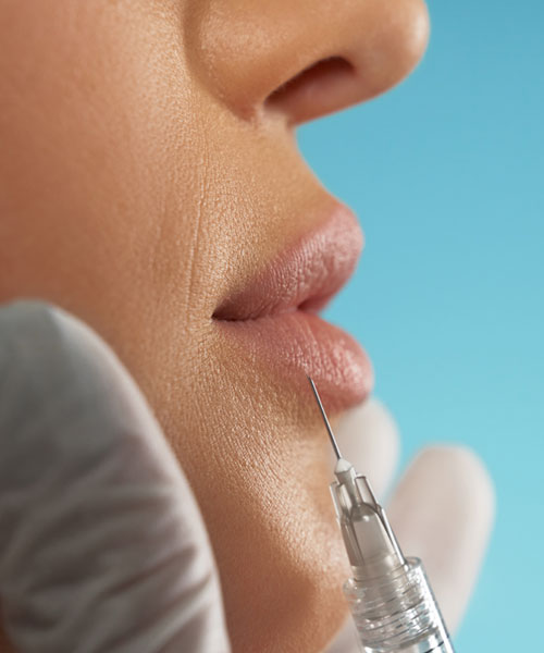 Lip and Face Fillers